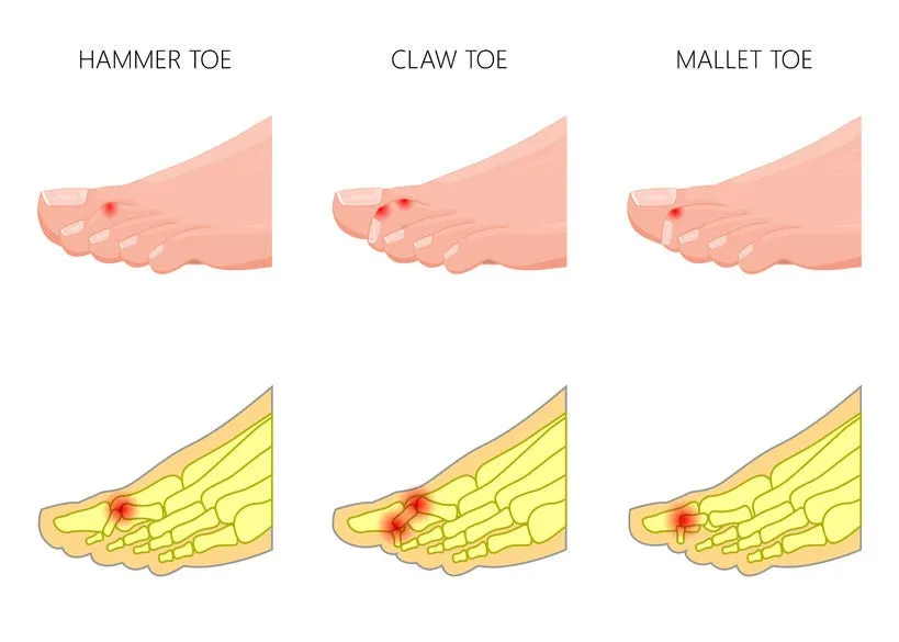 12 CE Hour Foot Reflexology Basics with Advanced Medical Foot Massage (Computer-Based Live Interactive Webinar)